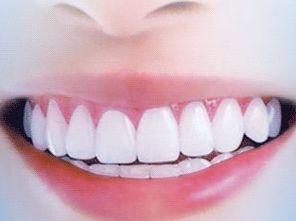 成人美白牙齿流程视频,告别黄牙困扰